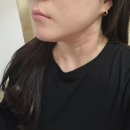 부산 서면다이어트한의원 지방분해 및 리프팅 2회차