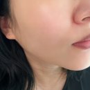 이아넬 | 하루 종일 당김 없는 보습세럼 추천, 이아넬 세럼 후기