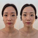 더골드 - 오산시 성호대로 108 | [양주] 3살은 어려진 옥정윤곽관리, 스파다온에서 받아본 뱀부 컨투어링 더 골드 후기