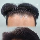 정 헤어라인 이미지