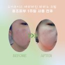 나무약국 | 약국화장품 유어초이스 세라바인 타마누 크림 홍조피부 1주일 사용 후기