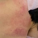 제주의료기 | &#39;세진스킨앤바디&#39; 바디케어 테라노바 후기