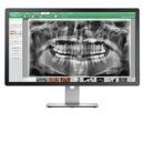 미래디지털치과기공소 이미지