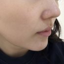 어진동세종파이낸스1차건너편 | [세종] 에스테틱핸즈온유 세종본점 아쿠아필 솔직후기