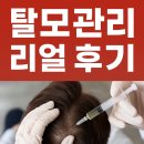 서울밸런스의원 | [내돈내산리뷰] 모멘텀헤어라인의원 서울 강남점 탈모관리 리얼 후기