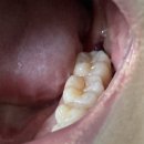 서울산보람병원(1) 이미지