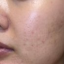 호호호약국 | 약국에서 판매되는 재생크림 연고보다 성분 높은 PDRN크림 리쥬올 솔직후기