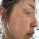 희망약국 | 약국 미백크림 효과 제대로 본 한달 후기