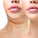 하프클리닉 후기 얼굴 라인 개선 원한다면