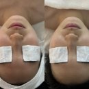 안동중앙고등학교 | 안동피부관리 지민뷰티에서 콜라겐윤곽관리 후기 - 꿀피부와 꿀잠 겟❣️
