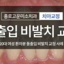 고운미소치과 네이버블로그