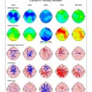 정가정의원 | 교대역 하이맵의원 TMS 후기