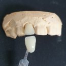 지안치과기공소 이미지