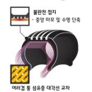 탄탄타이어 이미지