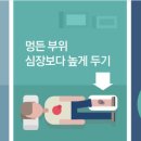 멍라이프 이미지