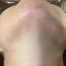 한그루한의원 | 다낭성 난소증후군 중간정산 | 중랑구 한그루 한의원 후기