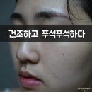 오르리뷰티 | [천안속눈썹연장] 메마른 피부에 수분 폭탄, 올가스킨