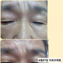 리포브구미