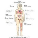 전신 홍반성 낭창 (루푸스) 이미지