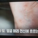 손과 발,얼굴 머리 전신에 흐르는 땀 이미지