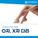 포항연세정형외과의원 O자 다리와 X자 다리의 차이점 및 치료 방법