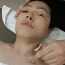 계룡타워 | 계룡피부관리 고운율 바디&amp;페이스 에스테틱 후기