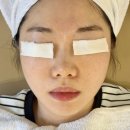 양덕동219 | 창원 여드름 피부관리 르메이에스테틱 후기