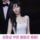 채움메디케어 | 정지소 성형설 부른 뼈말라 몸매, 매일 먹은 한 가지