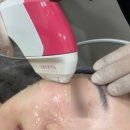 온재한의원 | [리뷰] 슈링크 유니버스 안양 한의원 효과본 후기 (300샷)