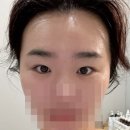 용카크리닉 | 화성 동탄) 동탄 에스테틱 전문점 엘리움 스파 강력 추천 후기
