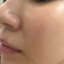 에스에이치유통 - 양천구 목동중앙북로 68 | 약국화장품 리쥬N28크림 PDRN NMN 듀얼 리페어 28일 사용변화