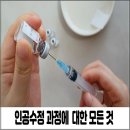 인공수정 과정/비용/예나트론 질정/3차/주의사항/물처럼 흐르는 냉
