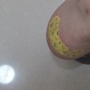 더조은게임 | [근황]달리지 않고 걸었던..? 기었던..? 8월