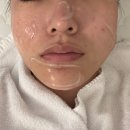 부평일번가 | 부평피부관리 데자뷰메디스킨 인천점 위치 주차 수분관리 후기