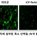 셀리버리 파킨슨 치료제 특허관련 신문 기사 이미지