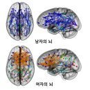 남자아이의 뇌 vs 여자아이의 뇌 이미지