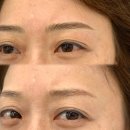 엘케이 | 청담 헤어스트록 눈썹 잘하는 곳 후기 at 엘케이뷰티엑시스