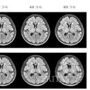 에이스 메디컬 이미지