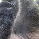 서울파머 | 임산부 탈모샴푸 추천, 두랩스 파머셀 엑소딘 스캘프 샴푸 사용 후기