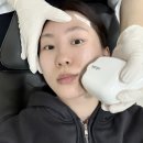 탄탄의원 | 바노바기의원 창원 내돈내산 올타이트 리프팅 300샷 솔직후기!