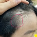 서울365소아청소년과의원 네이버블로그