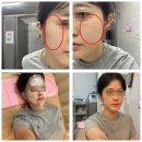 대명한의원 | 평촌] 범계역 가성비 미친 주근깨+기미 잡티 제거 레이저 찐맛집 "가로세로한의원" 내돈내산 솔직후기(1탄)