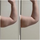 홍대입구역 8번 출구 앞 | 홍대입구역8번출구피부과에서 다이어트수액 및 바디윤곽주사 받은 후기