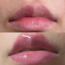 오버라인 | 💋대만족💋 입술 오버라인 반영구 한 달 차 내돈내산 후기 | 신촌・홍대