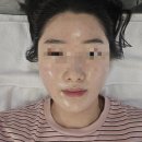 수원-0884 | 물광, 광채 피부 원한다면 수원 에이시왁싱의 액시드닝 추천