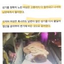 “아무한테도 못 줘” 바람난 남편 성기 ‘1cm’ 남기고 잘라버리고 염산 부은 아내 이미지