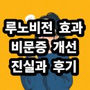 비전4로 | 루노비전 효과 있나요? 비문증 개선에 대한 진실과 후기 총정리