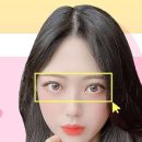 옐로우성형외과의원 이미지