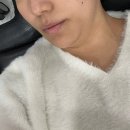 튠플러스 | 압구정 튠모드 리프팅 피부과 리얼 후기｜피부과 전문의 손길 닿은 내 얼굴라인