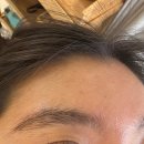 희헤어라인 이미지